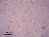 4 - Cellule stellate e cellule secretrici della zona midollare